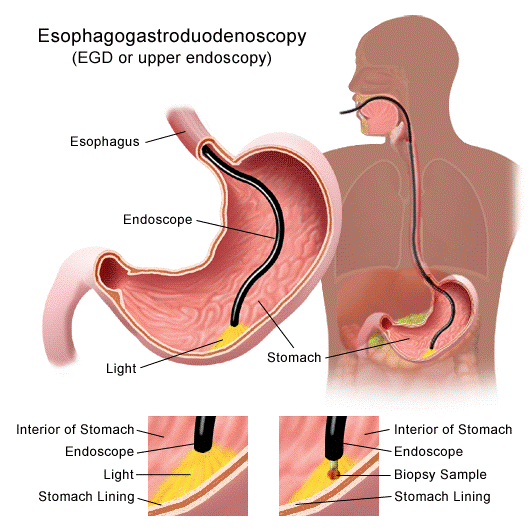 Is colonoscopy painful