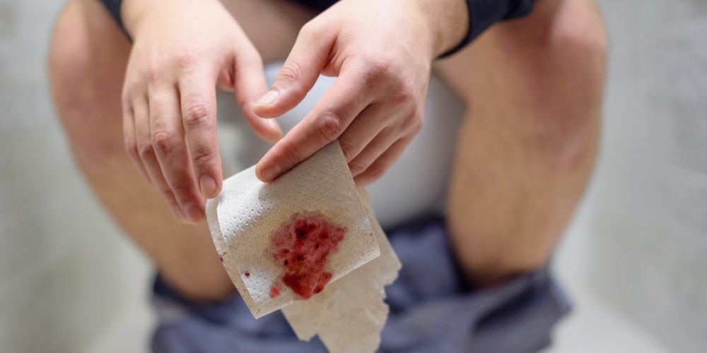 Why Is There Blood in My Stool? Causes, Concerns & When to See a Doctor
