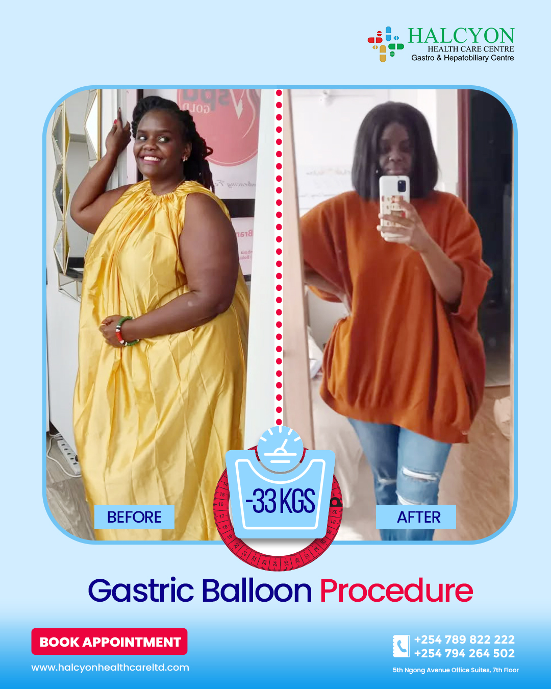 Mamake Bobo <strong style="color:#0c0b42;">Weight Loss Journey</strong> with Allurion Gastric Balloon
